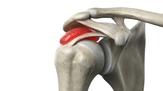 Anatomia do ombro sob pressão ao deitar
